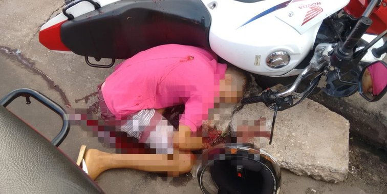 Suspeito de assalto não resiste e morre no HUT após ser baleado
