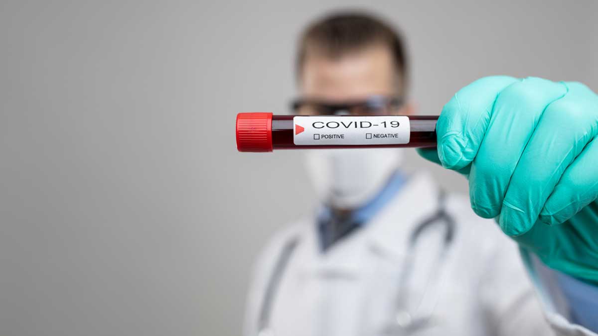 Piauí reduz em mais de 70% os óbitos e novos casos por Covid nos últimos 14 dias, revela Sesapi