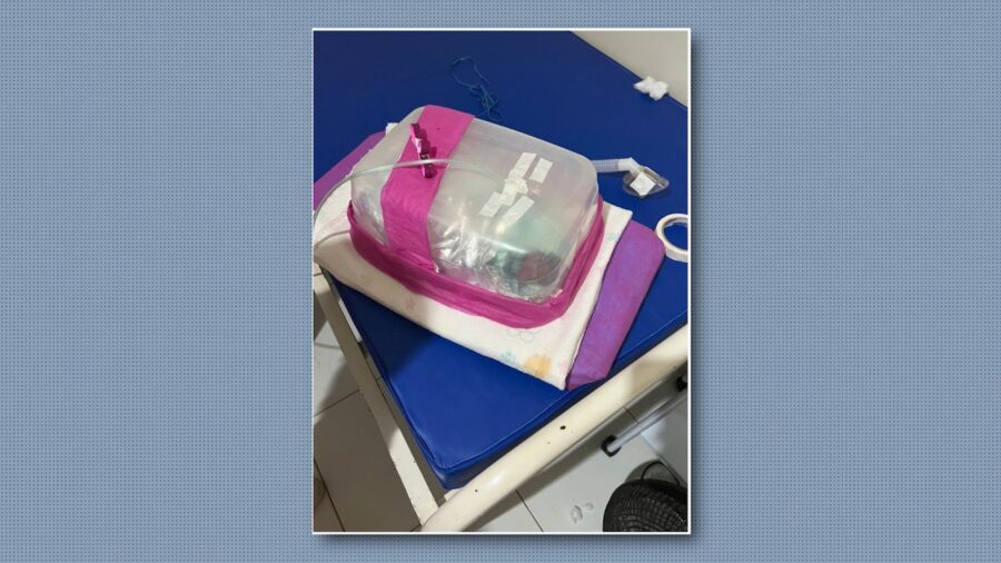 Bebê nasce com 1 kg e é transferida do Sul do Piauí dentro de boleira