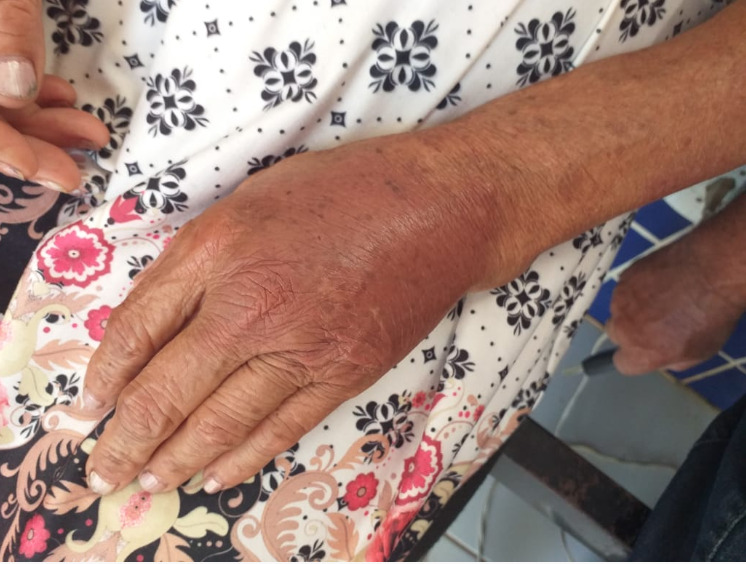 URGENTE: Idosa de 65 anos é estuprada por dois adolescentes em Monte Alegre