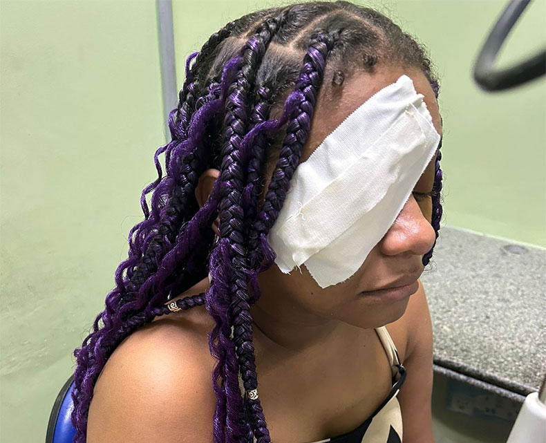 HUT atende 21 pacientes com queimaduras por uso de pomadas para modelar cabelos