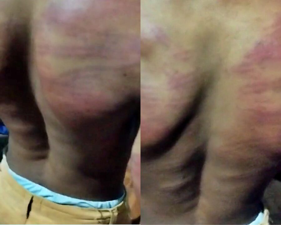 Policiais militares são afastados após denúncia de agressão a jovem quilombola em Redenção do Gurgueia