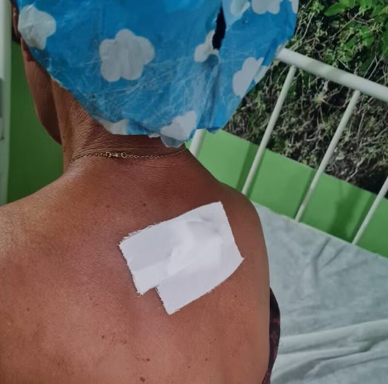 Filho é preso por tentativa de feminicidio após esfaquear a própria mãe nas costas em Curimatá