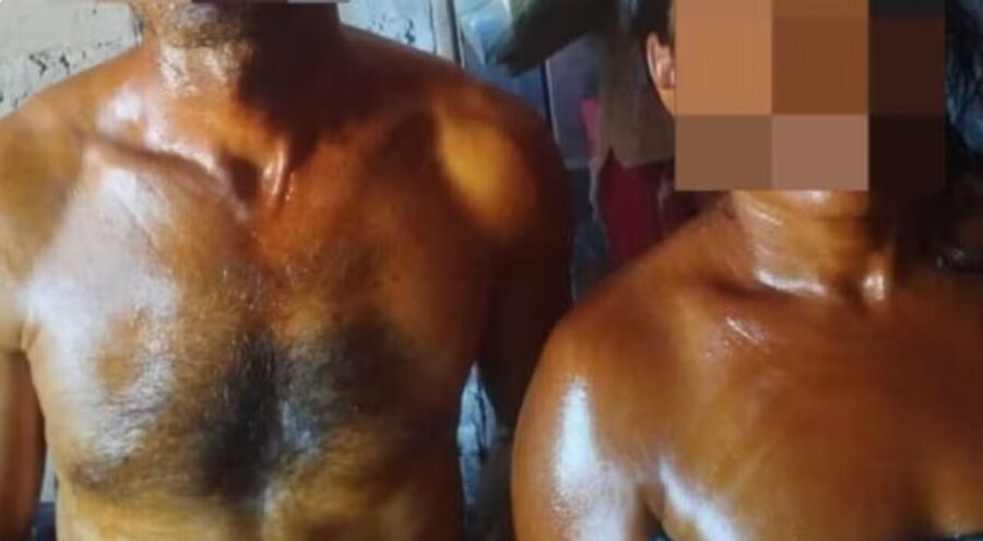 Incêndio de grandes proporções invade propriedade rural e casal sofre queimaduras ao tentar apagar fogo, em Canto do Buriti